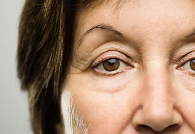 Ophthalmologist and Oculoplastic surgeon Julian Perry, MD: The Best Options for Droopy Eyelids, Circles and Sags